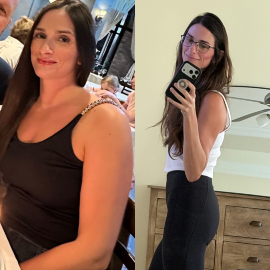 Ashley’s personal journey photo 2 — comparison collage