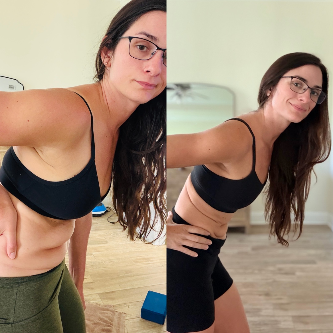 Ashley’s personal journey photo 7 — comparison collage